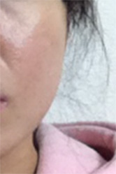 開ききっていた毛穴が・・・